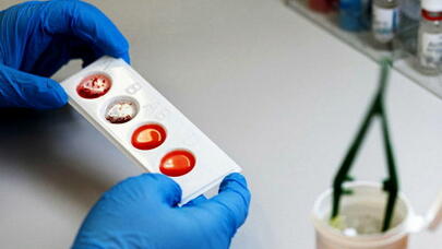 Valideynlərin qan qrupu uşaqların istedadına təsir edirmi?