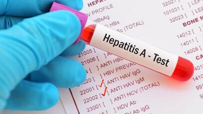 Hepatit C virusunun psixiatrik pozğunluqlarla əlaqəsi aşkarlandı