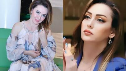 Gülyaz Məmmədova tanınmaz halda - Foto