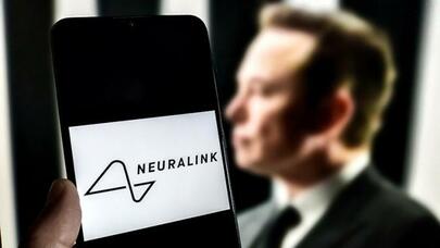 İnsan beyninə çip yerləşdirildi: bu, zombi apokalipsisinin başlanğıcı ola bilərmi?