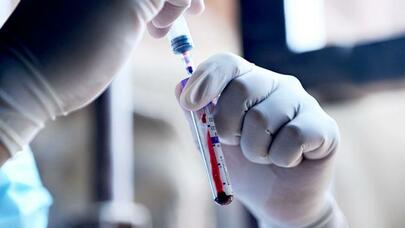 ABŞ-da cinsi yolla ötürülən amansız xəstəlik 80 faiz artdı