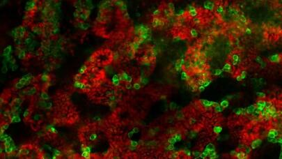 Alimlər laboratoriyada testislər inkişaf etdirməyə müvəffəq oldu