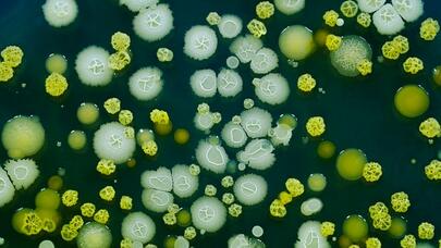 Bağırsaqda bəslədiyimiz "SƏSSİZ KABUS": 800 min nəfəri məhv edib