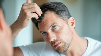 Saç tökülməsinin daha bir səbəbi: "Müalicə sıfır təsir göstərəcək"