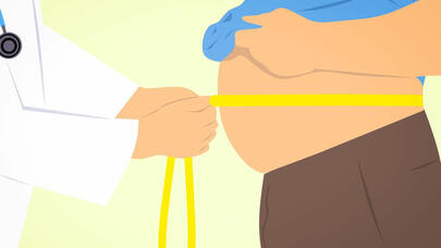 Artıq çəkinin irsi olub-olmadığı məlum oldu