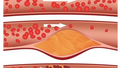 Bu 4 vərdişdən uzaq olun: İnanılmaz zərərləri