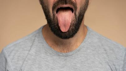 Sağlam insanın dili belə görünür