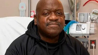 Dünyanın donuz böyrəyi köçürülən ilk insanı öldü