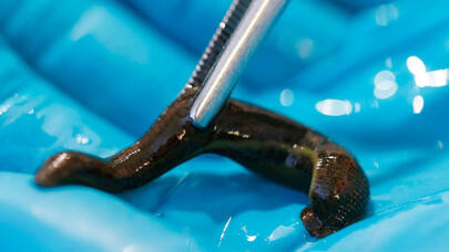 Bundan sonra zəliləri bu cihaz əvəz edəcək - FOTO