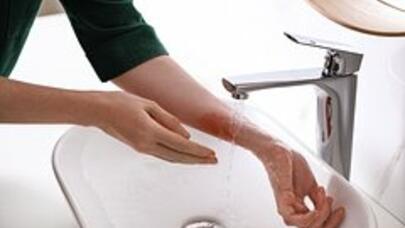 Yanıq xəsarəti aldıqda öncə bunu etməlisiniz