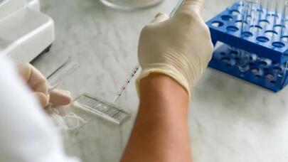 Xərçəng xəstələrinə şad xəbər: Yeni qan testi müalicəni asanlaşdıracaq