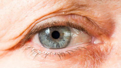 MÖCÜZƏVİ KƏŞF: yaşla bağlı korluğun qarşısı alındı