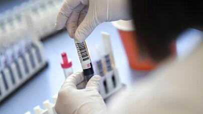 Koronavirusun yeni simptomu AŞKAR EDİLDİ