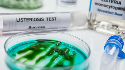 ABŞ-də epidemiya: daha 28 nəfər təhlükəli xəstəliyə yoluxdu