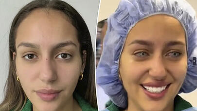 Azərbaycanda göz rənginin dəyişdirilməsi qadağan ediləcək? - ARAŞDIRMA