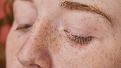 Çillər hansı halda xərçəngə işarədir? - Alimlər təhlükəli əlaməti açıqladı