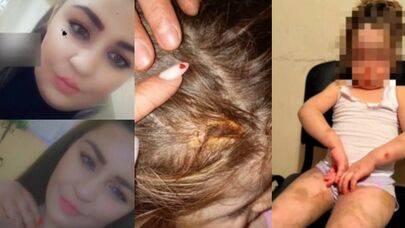 Azyaşlı qızına vəhşicəsinə işgəncə verən ana HƏBS EDİLDİ