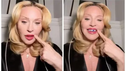 Madonna dişlərini brilyantlarla bəzədi - VİDEO