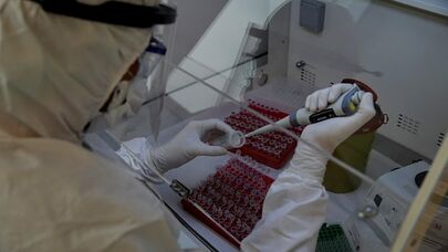 Fəlakət gəlir: "COVID-19"dan da betər virus aşkarlandı