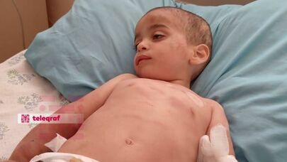 Ağdamda 2 yaşlı uşağını döyüb xəstəxanalıq edən ata saxlanıldı - FOTO