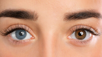 İnsanın tək gözü olub və bu əzada yerləşib - ŞOK ARAŞDIRMA