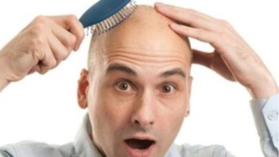 Həkimlərdən maraqlı açıqlama: Keçəl kişilər daha enerjili və...