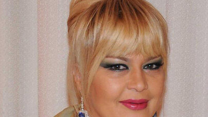 Əməkdar artist üz gərmə əməliyyatından sonra BELƏ OLDU - VİDEO