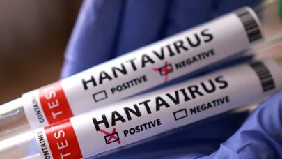 ÜST hantavirusla bağlı yayılan bu məlumatı təsdiqlədi