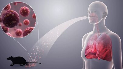 Hantavirus böyrəklərin fəaliyyətini dayandırır və… - Virusoloq xəbərdarlıq etdi
