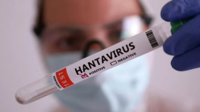 Fransada ilk hantavirus infeksiyası təsdiqləndi