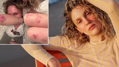 Farah Zeynep Abdullaha nə olub? - FOTO
