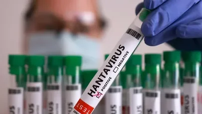 Belarusda hantavirus təhlükəsi: Hər il onlarla yoluxma qeydə alınır