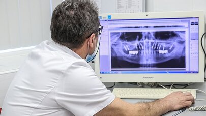 Xəstə dişlərin ürəyə və beyinə ciddi təsiri aşkar edildi