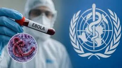 ÜST-dən “Ebola” virusu ilə bağlı xəbərdarlıq - Vəziyyət ağırlaşır