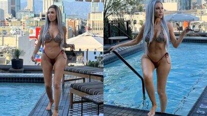 Bu məşhur plastik əməliyyatlara 1 milyon xərcləyib: Ağzını aça bilmir