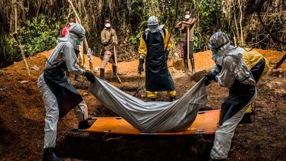 Ebola virusunun təhlükəli variantı - “Təsiri dağıdıcı ola bilər”