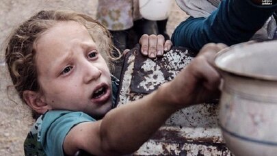 Dünyada hər 10 saniyədə bir uşaq aclıqdan ölür