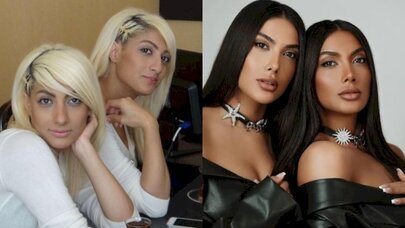Estetiklə görünüşünü dəyişən azərbaycanlı məşhurlar - FOTO