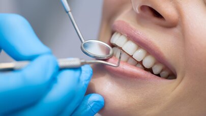 Bakıda pasiyent müalicə olunduğu diş həkimindən 50 min manat aldı - TƏFƏRRÜAT