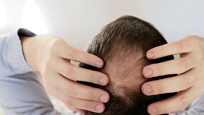 Arıqlamaq istəyən kişilərə XƏBƏRDARLIQ: Bu dərmanlar saçınızı tökəcək