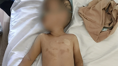 Həmin 3 yaşlı uşağın anasının valideynlik hüququ məhdudlaşdırıla bilər - FOTO