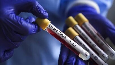 Bu ölkədə eboladan ilk ölüm halı qeydə alındı
