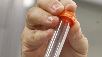 Diabet xəstələrinə MÜJDƏ: Bu vitamin yaddaşı qoruya bilər