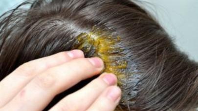 Ağarmış saçlara qarşı soğan maskası - FOTOLAR