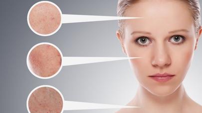 Hamiləlik ləkələrini aradan qaldıran təbii üsul