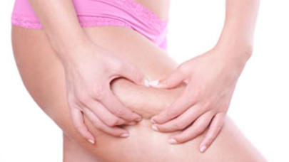 Bu qidalar sayəsində sellülitlərdən xilas olun!