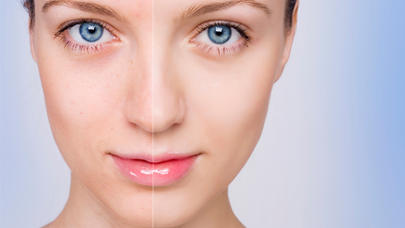 Boyun, sinə və əllərdəki qəhvəyi rəngli ləkələri yox edən maskalar