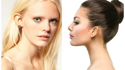 Şəlpə qulaqlar artıq əməliyyatsız düzəldilir