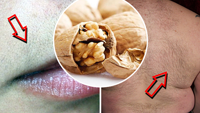 Qoz qabığı ilə tüklərdən xilas olun!