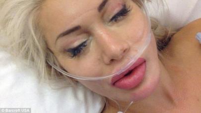 Qabırğalarını götüzdürən qız bu hala düşdü – FOTOLAR